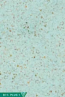 Ventrawall B11-PLUS1 - Altın Turkuaz Duvar Kağıdı